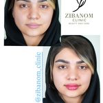 کیلینیک زیبا نوم
