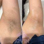 مرکز لیزر و کلینیک زیبایی آروین