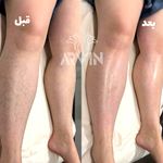 مرکز لیزر و کلینیک زیبایی آروین