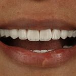 دندانپزشکی دکتر مریم ولائی