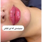 مرکز لیزر و زیبایی حورا