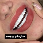 دندانپزشکی دکتر مصطفی محمدی( لبخند)