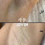 مرکز لیزر و کلینیک زیبایی آروین