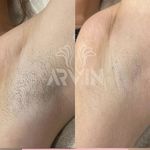 مرکز لیزر و کلینیک زیبایی آروین