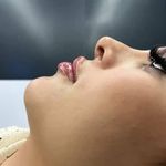 مرکز لیزر و زیبایی زروانی