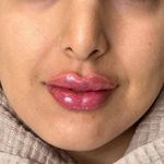 مرکز لیزر و زیبایی زروانی