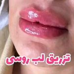 مرکز لیزر و زیبایی زروانی