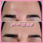 مرکز لیزر و زیبایی زروانی