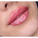 مرکز لیزر و زیبایی زروانی
