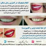 دندانپزشکی دکتر مصطفی محمدی( لبخند)