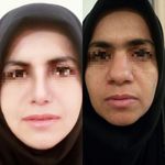 دکتر مهرانگیز کابلی باغ سیاهی