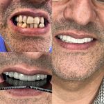 دندانپزشکی دکتر مصطفی محمدی( لبخند)