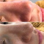 کیلینیک فیشیال و پاکسازی پوست