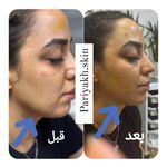 فیشیال و پاکسازی تخصصی پریا خاوران