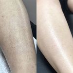 مرکز لیزر و کلینیک زیبایی آروین