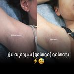 مرکز لیزر موهای زائد بهار