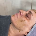 پاکسازی پوست کیمیا صدری