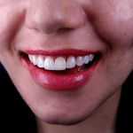 دندانپزشکی دکتر مصطفی محمدی( لبخند)