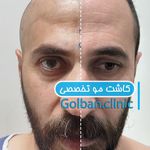 کلینیک زیبایی گلبان