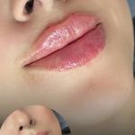 کلینیک زیبایی مرکز لیزر نورا