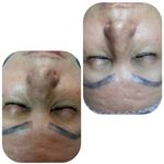 کلینیک پاکسازی وفیشیال پوست آلا بانو