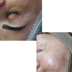 کلینیک پاکسازی وفیشیال پوست آلا بانو