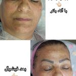 کلینیک پاکسازی وفیشیال پوست آلا بانو
