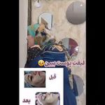 کلینیک پاکسازی وفیشیال پوست آلا بانو