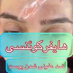 کیلینیک فیشیال و پاکسازی پوست