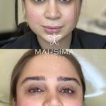 کلینیک تخصصی لیزر پوست مو مه سیما