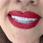 دندانپزشکی دکتر مصطفی محمدی( لبخند)