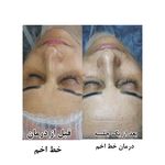 کلینیک پاکسازی وفیشیال پوست آلا بانو