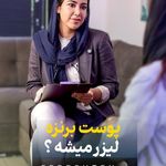 لیزر فرشته