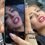 دندانپزشکی دکتر مصطفی محمدی( لبخند)