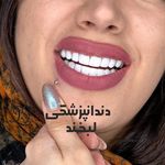 دندانپزشکی دکتر مصطفی محمدی( لبخند)