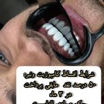 دندانپزشکی دکتر مصطفی محمدی( لبخند)