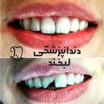 دندانپزشکی دکتر مصطفی محمدی( لبخند)