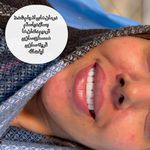 دندانپزشکی دکتر مصطفی محمدی( لبخند)
