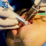 دندانپزشکی دکتر مصطفی محمدی( لبخند)