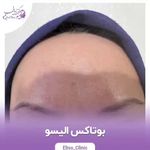 مرکز لیزر و کلینیک زیبایی الیسو
