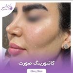 مرکز لیزر و کلینیک زیبایی الیسو