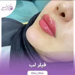 مرکز لیزر و کلینیک زیبایی الیسو