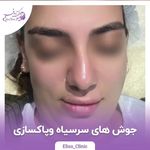 مرکز لیزر و کلینیک زیبایی الیسو