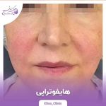 مرکز لیزر و کلینیک زیبایی الیسو