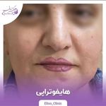 مرکز لیزر و کلینیک زیبایی الیسو