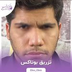 مرکز لیزر و کلینیک زیبایی الیسو