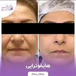 مرکز لیزر و کلینیک زیبایی الیسو