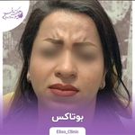 مرکز لیزر و کلینیک زیبایی الیسو