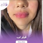 مرکز لیزر و کلینیک زیبایی الیسو