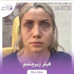 مرکز لیزر و کلینیک زیبایی الیسو